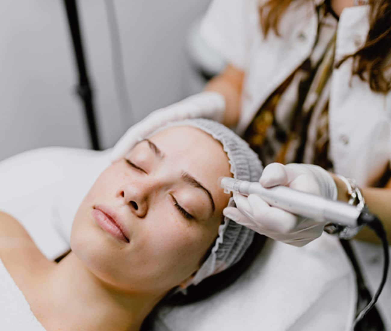 Patient receiving RF Microneedling