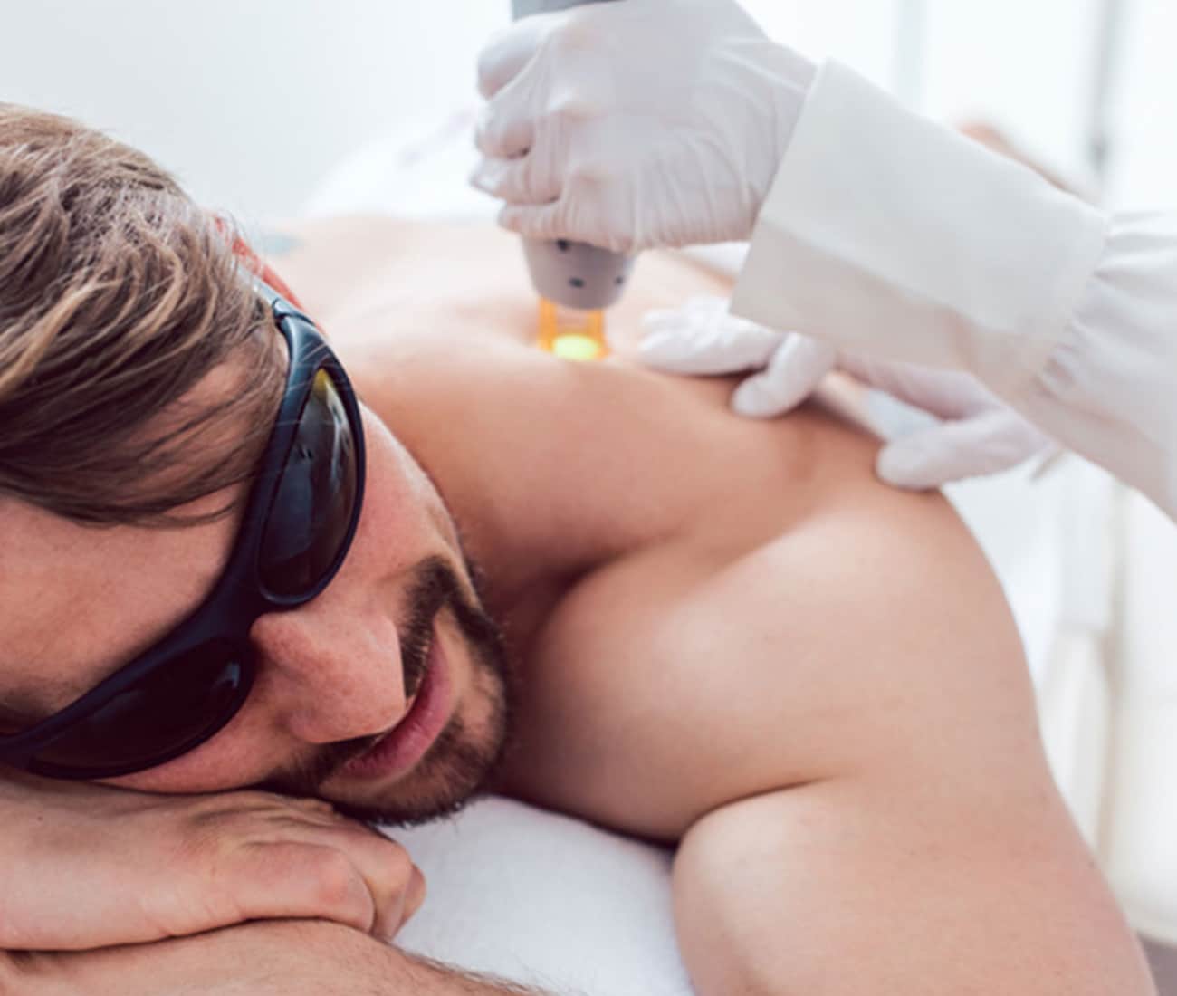 man receiving laser hair removal treatment on back