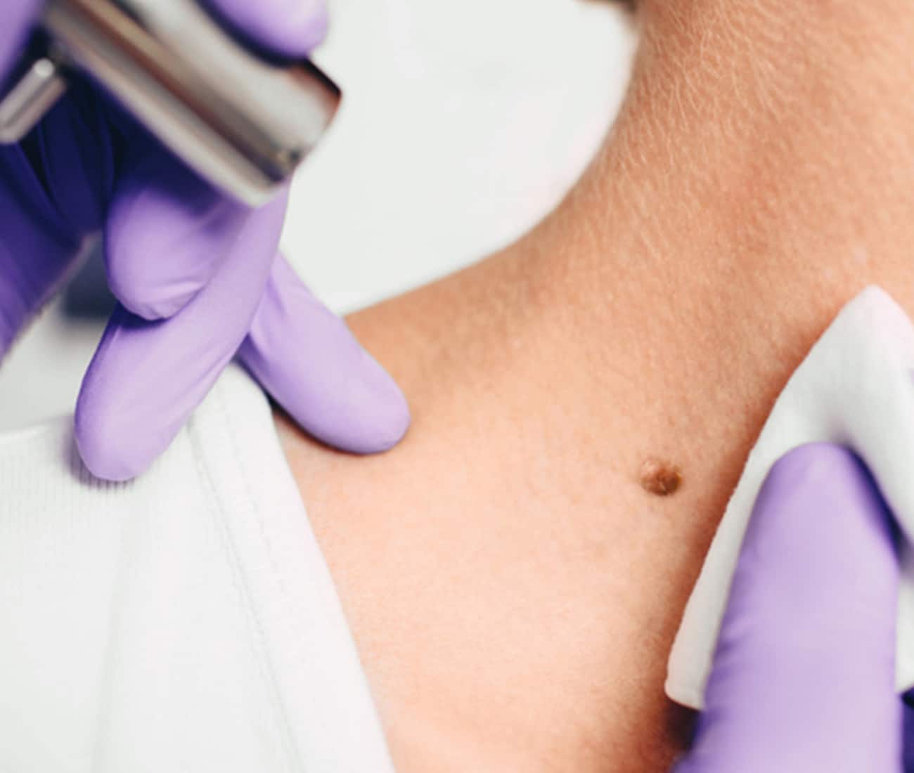 Doctor looking at patients mole on neck