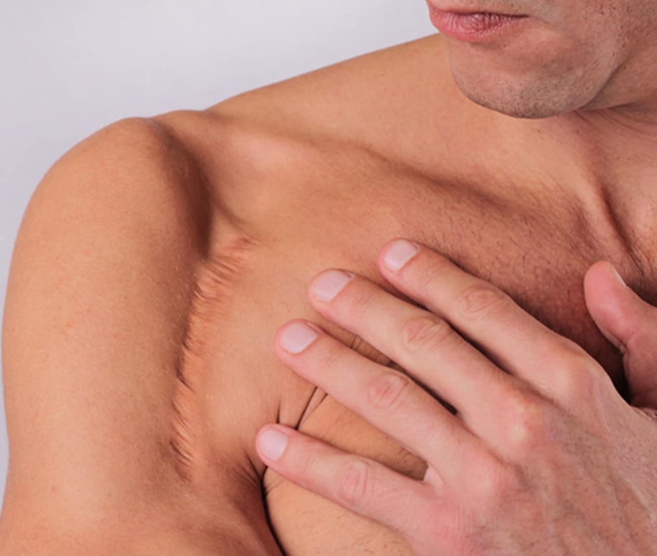 man looking at his shoulder scar